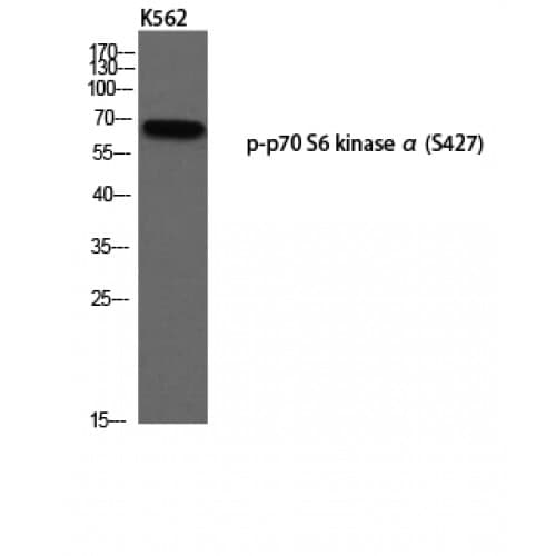 RPS6KB1 / P70S6K / S6K Antibody (370-450 aa)