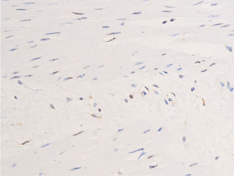 EGFR Antibody (phospho-Ser1071)