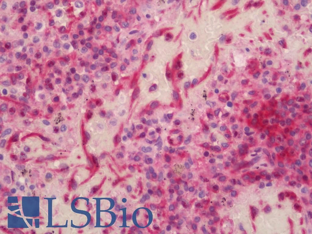Polyclonal Rabbit anti-Human CD40 Antibody (aa258-277, IHC, WB)