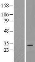 DNAJC22 / FLJ13236 Protein (Over-Expression Lysate Myc-DDK (Flag))