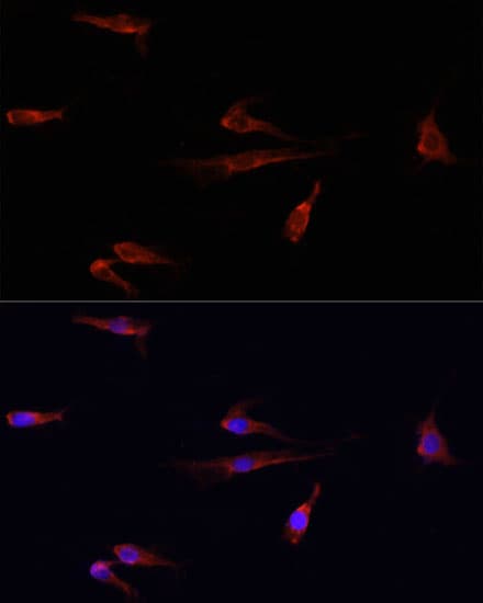 Polyclonal Rabbit anti-Human EGFR Antibody (IHC, IF, WB)