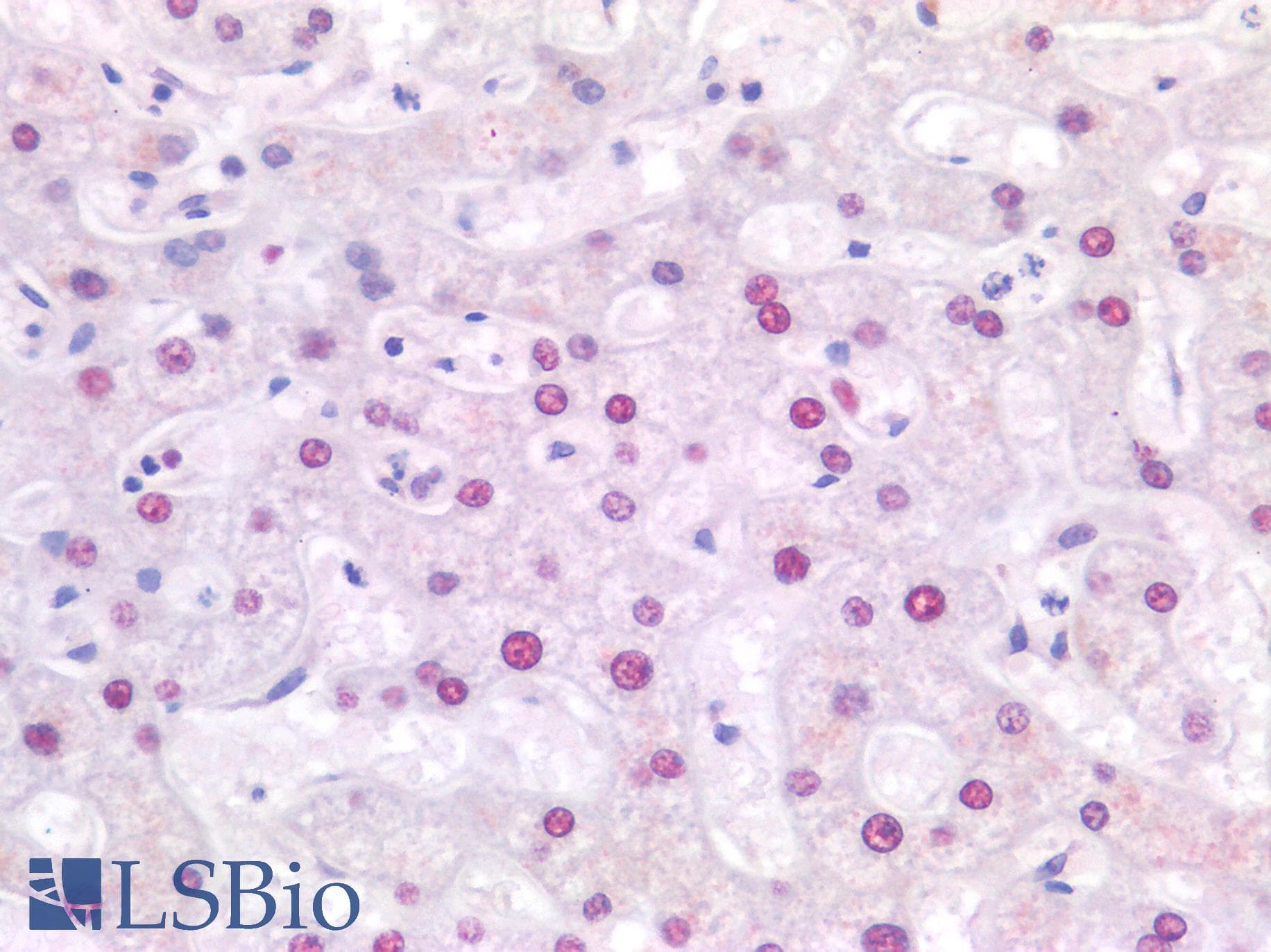 PathPlus™ Polyclonal Rabbit anti-Human SSB / La Antibody (aa366-397, IHC, WB)