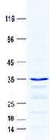 Human Statherin / STR Protein (Recombinant GST, N-terminus + His, C-terminus)