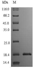Human IL3 Protein (Recombinant 6His, C-terminus)