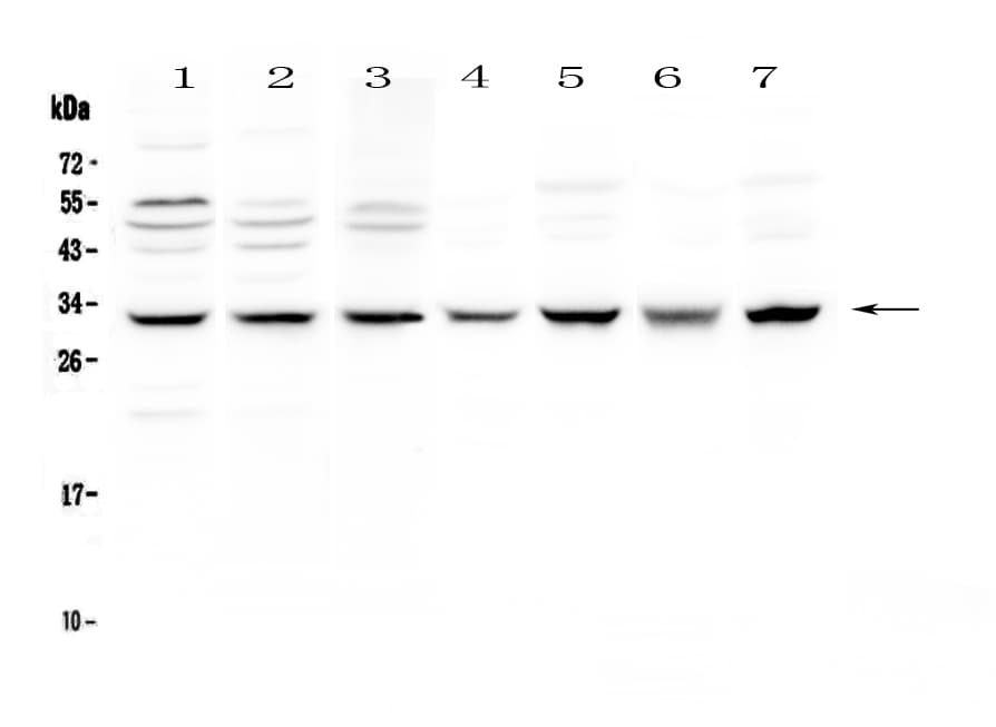 SDHB Antibody