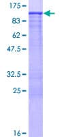 Human FMN1 Protein (Recombinant GST)