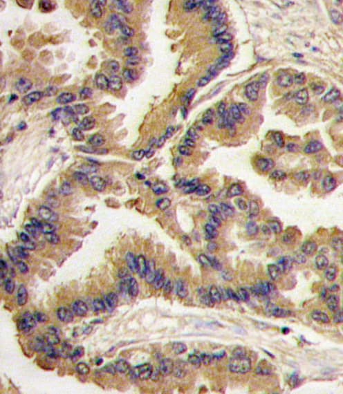 BMP6 Antibody (aa25-55)