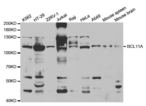 IHC-plus™ BCL11A Antibody