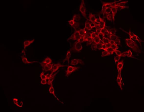 FST / Follistatin Antibody