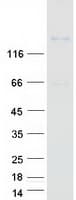 Human PCDH17 Protein (Recombinant Myc-DDK (Flag))
