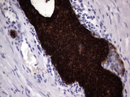 Monoclonal Mouse anti-Human KRT19 / CK19 / Cytokeratin 19 Antibody (clone OTI6E8, aa240-390, IHC)