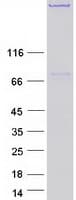 Human MAP2 Protein (Recombinant Myc-DDK (Flag))