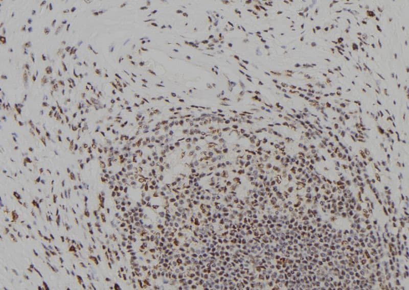 Polyclonal Rabbit anti-Human ORC2L / ORC2 Antibody (IHC, WB)