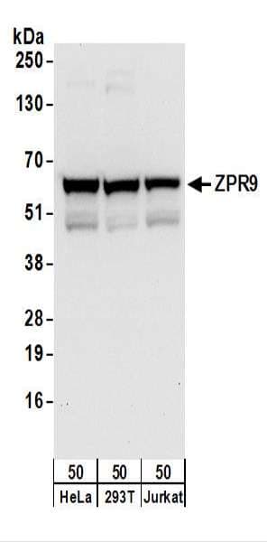 ZNF622 Antibody (aa125-175)
