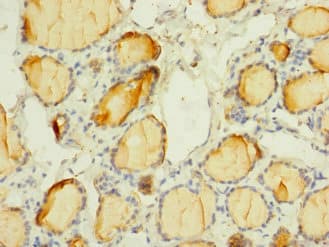 SCN3A / Nav1.3 Antibody