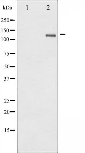 SREBF1 / SREBP-1 Antibody (phospho-Ser439)