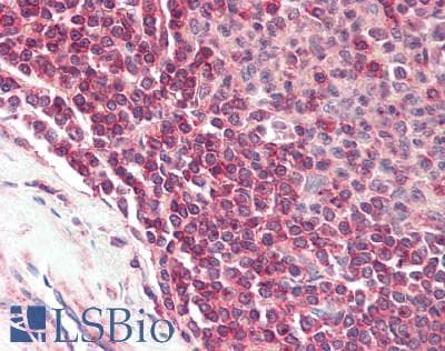 IHC-plus™ Polyclonal Rabbit anti-Human PIK3R5 Antibody (aa1-494, IHC)