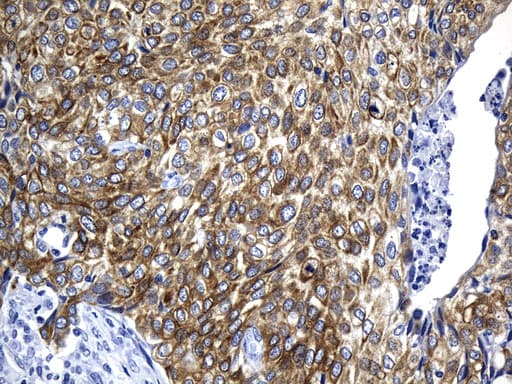 Monoclonal Mouse anti-Human AGR2 Antibody (clone UMAB245, aa21-175, IHC)