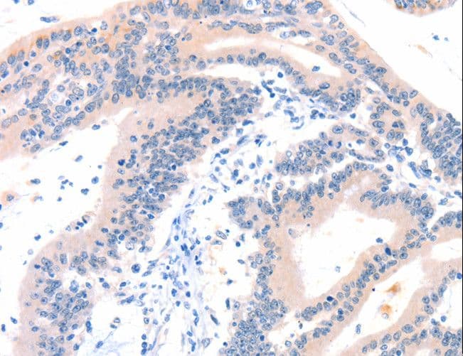 Polyclonal Rabbit anti-Human ITGA6/Integrin Alpha 6/CD49f Antibody (IHC)