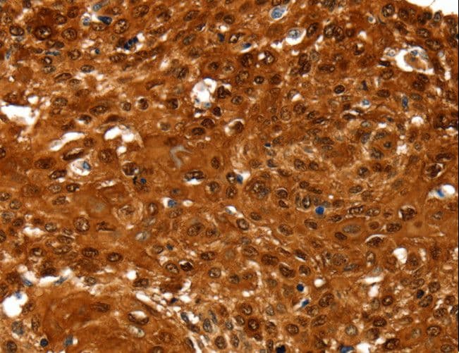 Polyclonal Rabbit anti-Human N-CoR / NCOR1 Antibody (IHC)