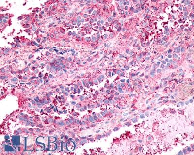 PathPlus™ NPFFR1 / GPR147 Antibody (Extracellular Domain)