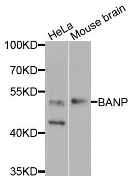 Polyclonal Rabbit anti-Human BANP Antibody (WB)