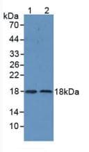 SOD1 / Cu-Zn SOD Antibody (aa2-154)