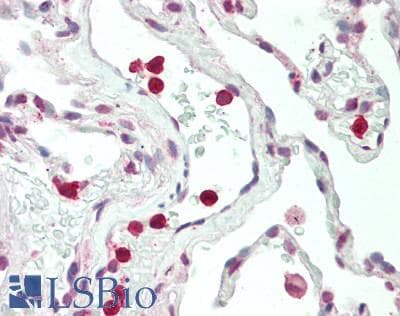 IHC-plus™ Polyclonal Rabbit anti-Human WASF2 / SCAR2 Antibody (aa125-174, IHC, WB)