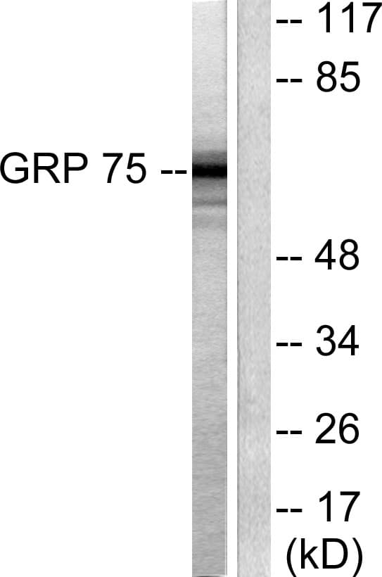 PathPlus™ HSPA9 / Mortalin / GRP75 Antibody (aa630-679)