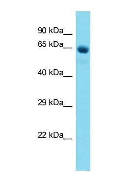 NR4A1 / NUR77 Antibody (aa484-533)