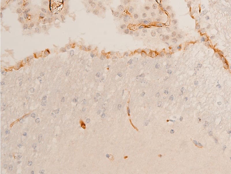 CHEK2 / CHK2 Antibody (phospho-Thr68)