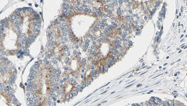 GAS2L1 Antibody