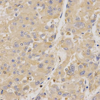 MUSK Antibody