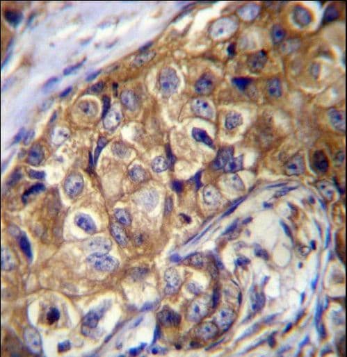 CTAGE5 Antibody (aa775-804)