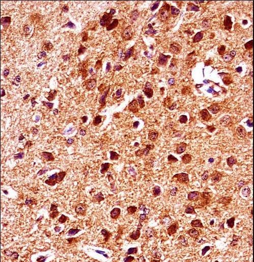 GSK3B / GSK3 Beta Antibody (aa30-59)