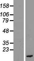 Human PKIB Protein (Over-Expression Lysate Myc-DDK (Flag))