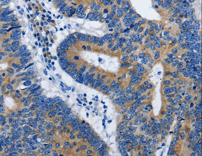 BPIFB3 / C20orf185 Antibody