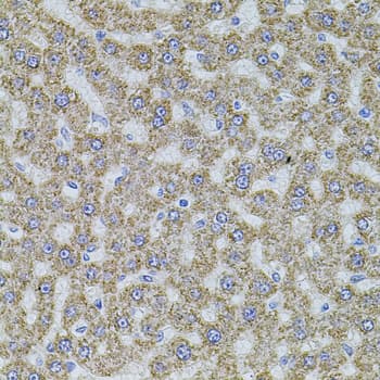 ALDH1A1 / ALDH1 Antibody