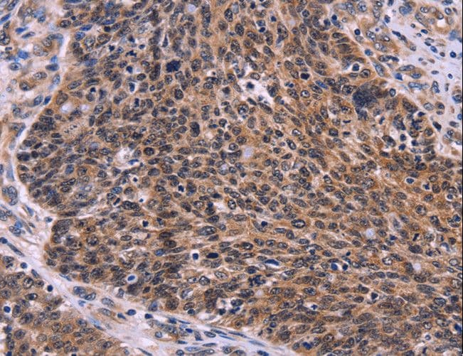 CDC5 / CDC5L Antibody
