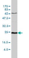 SDF2 Antibody (clone 3G7-1D6)