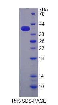 Human CPSF160 / CPSF1 Protein (Recombinant His-S)