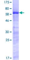 Human SURF2 / SURF-2 Protein (Recombinant GST)