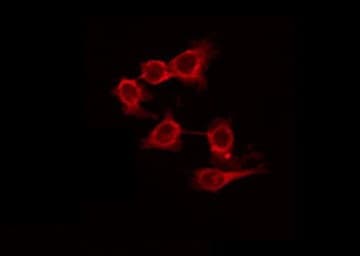 GRM7 / MGLUR7 Antibody
