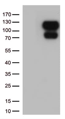 Monoclonal Mouse anti-Human MAPT / Tau Antibody (clone UMAB239, aa623-758, IHC, WB)
