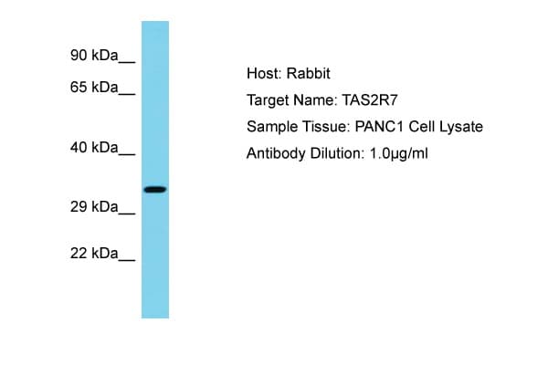 Polyclonal Rabbit anti-Human TAS2R7 / T2R7 Antibody (aa155-204, WB)