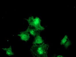MEIS3 Antibody (clone OTI1E4)