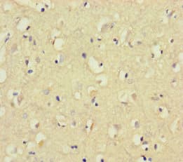 CNGA4 Antibody