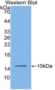 ACE / CD143 Antibody (aa334-409, Cy3)