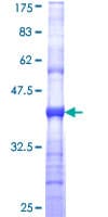 Human KCNJ10 / SESAME / KIR4.1 Protein (Recombinant GST, N-terminus)