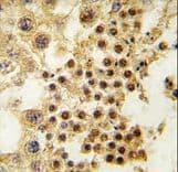 GDF3 Antibody (aa170-197)